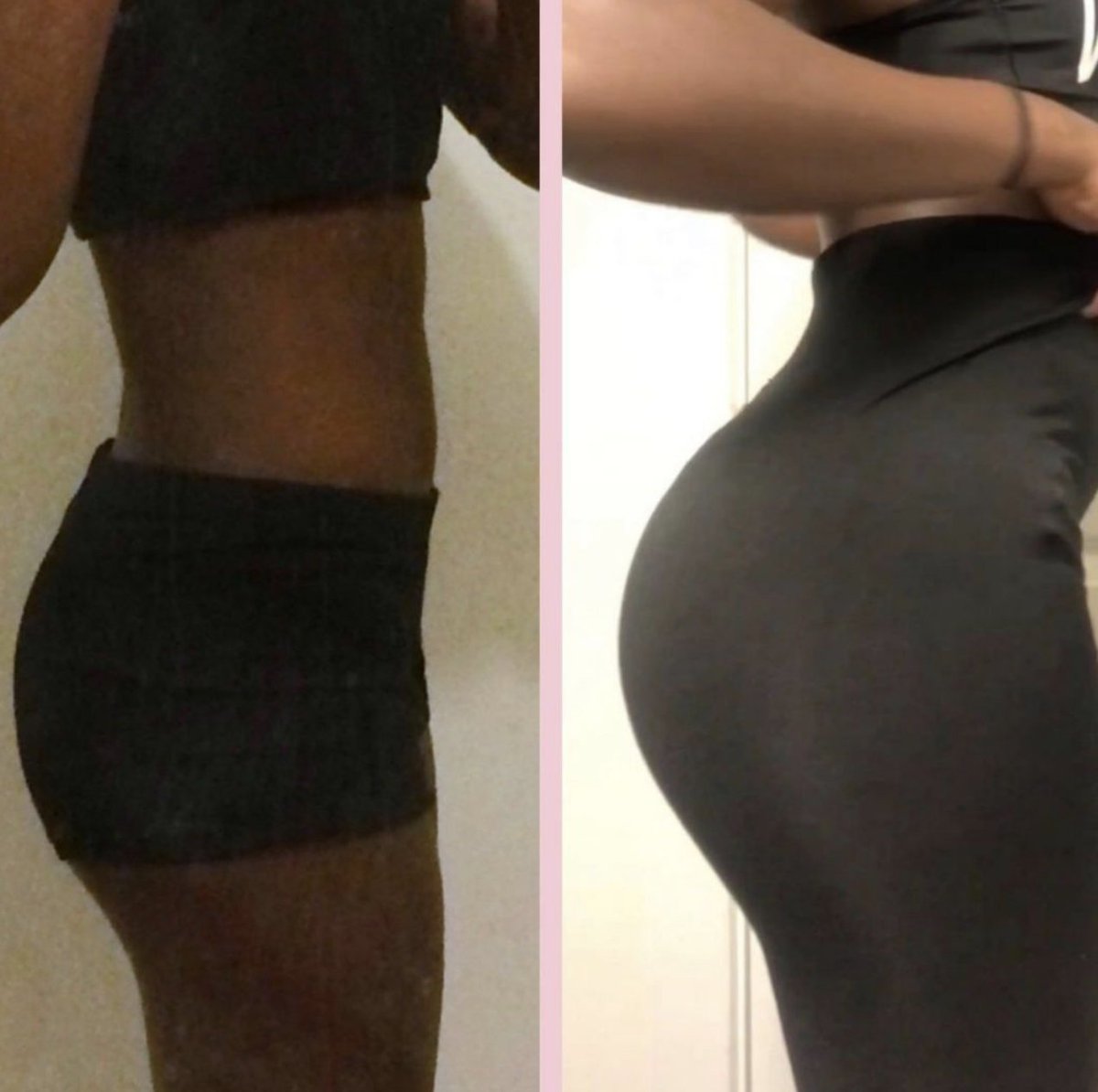 FFFlawlessbabes's tweet photo. Take a look at these before and after shots! -> https://t.co/2VD4KGROby
#bootygains #bootygoals #peachbum #peachyperfect #phatty #thefitfineflawless https://t.co/kGnKBnnc8c