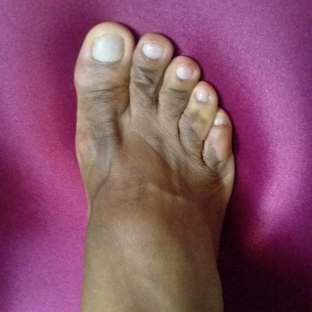GAY FEET GUYS FANS SPAIN on Twitter "RT lamepiesvaronil