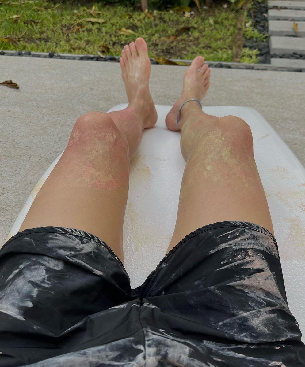 athaphaen's tweet photo. ᅠ
Cutie PP and my stained legs.
ᅠ https://t.co/AjRDQnBW1y