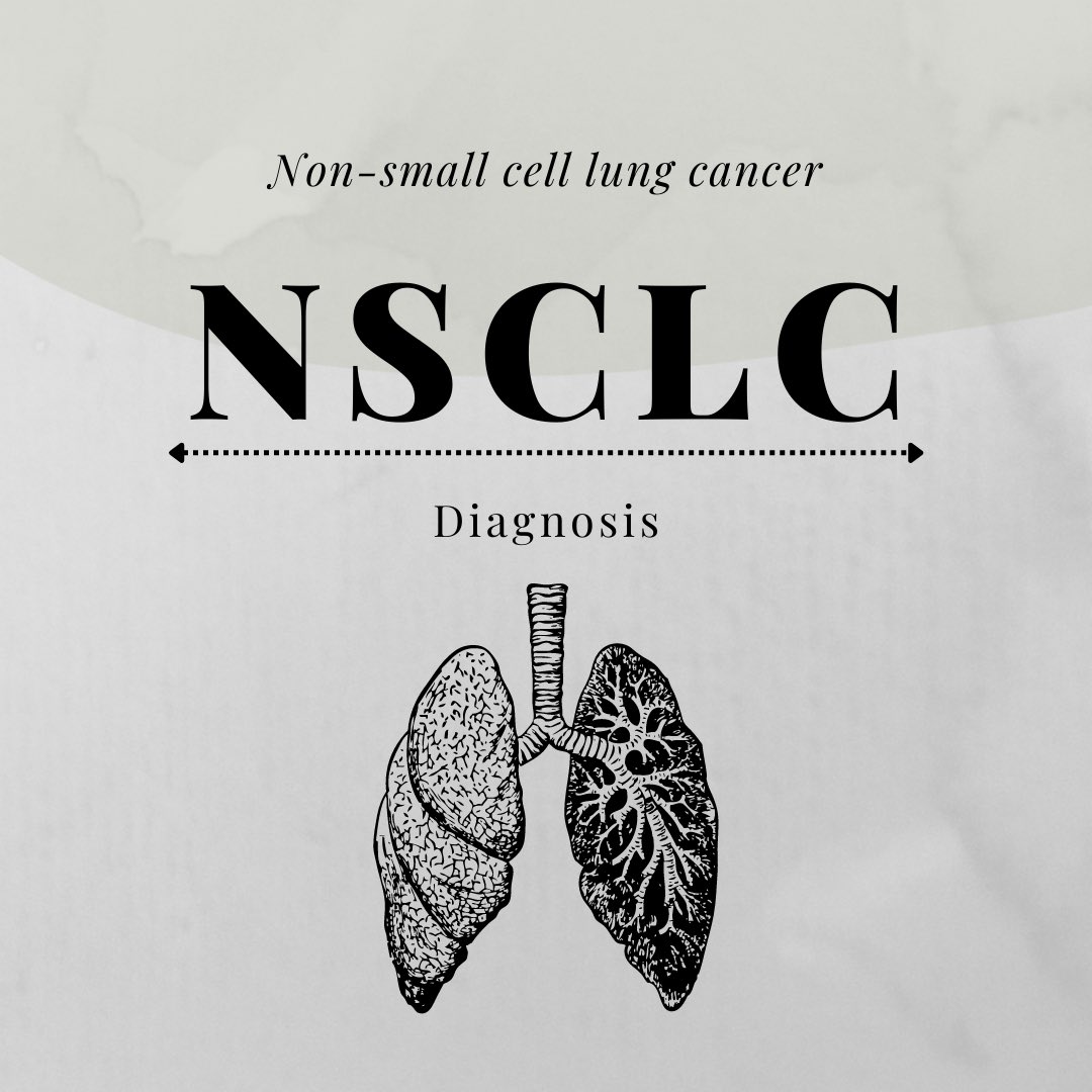 origenenation's tweet photo. Cancer: one of the most terrifying diseases one could imagine suffering from. But have you wondered how doctors diagnose this omnipotent disease? Well, for starters, they sometimes struggle to reach a consensus too! https://t.co/VXpB2AdziJ