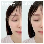 「まぶた重い、顔が浮腫む、頭スッキリしない」にはコレを30秒3セットがおススメ!