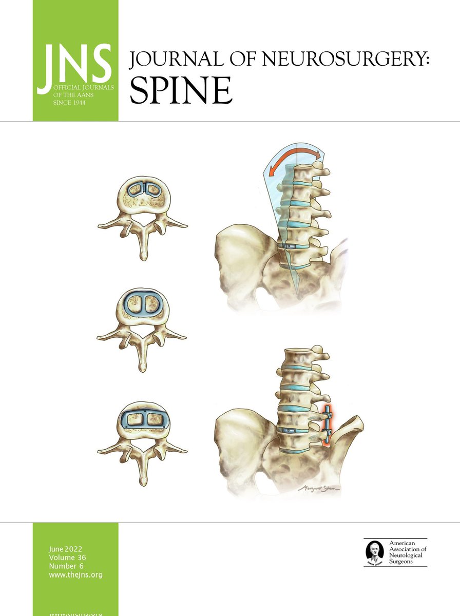 First cover! Thank you, @TheJNS! Always grateful for opportunities to work with pioneering @JohnHShinMD and the @MGHNeurosurg team. Curious about improving stability after spinal fusion? Check out the team's novel multifaceted biomechanical analysis here: bit.ly/3xhnW8S