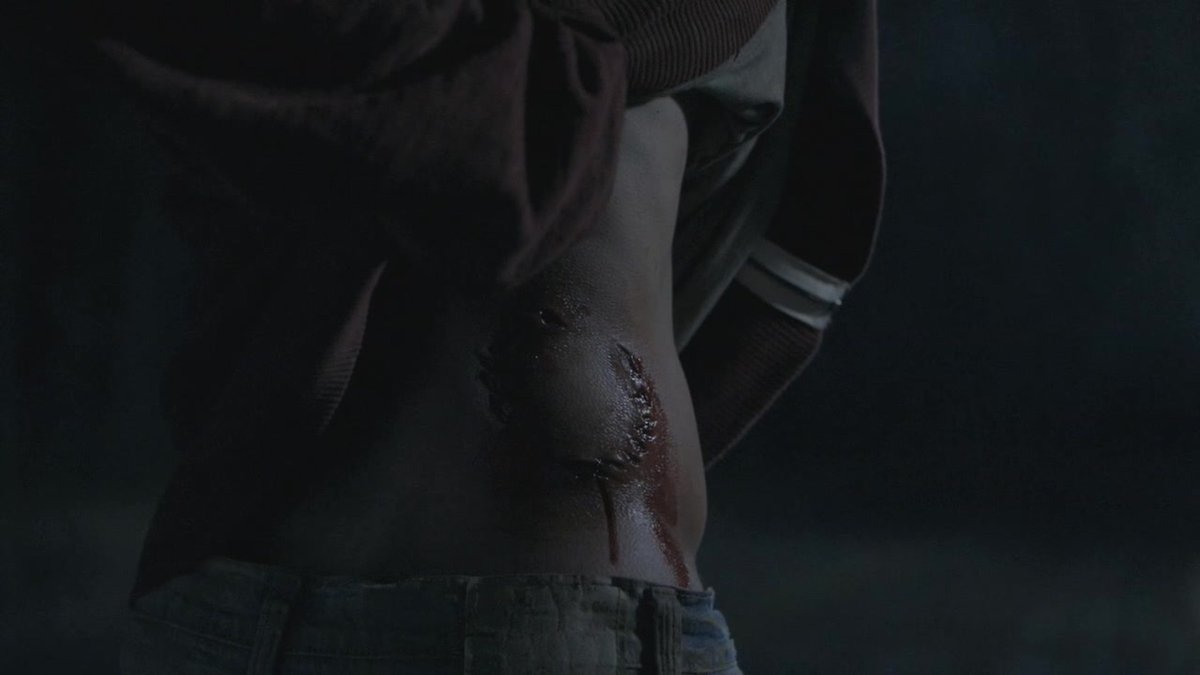 twscenesx's tweet photo. eleven years ago stiles convinces scott to go look for a missing body in the woods and scott is bitten #11YearsOfTeenWolf https://t.co/a54ei1liNh