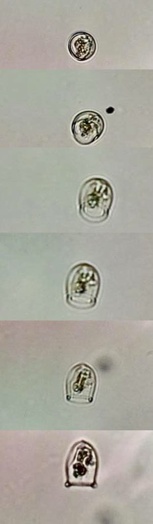 A bell shaped tintinnid (?) stopped in front of the camera for some pictures as it did a full 180. Top photo: top view, bottom photo: side view

#nwabcp #planktoscope