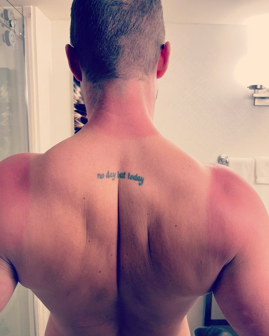 Oops! Forgot the sunscreen https://t.co/cgD8nGGKL3<a href="/tag/showheart"class="tags"><span>#showheart</span></a>