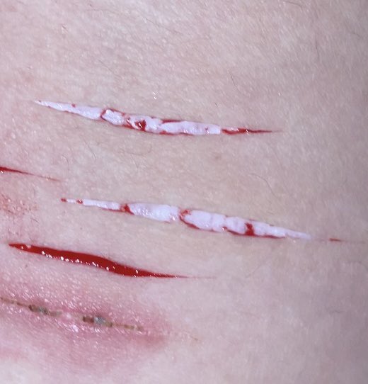 letsgototherapy's tweet photo. styrotwt ouchietwt shtwt catscratchtwt sliceytwt barcodetwt

love it <3 https://t.co/4ojkRGWnhw