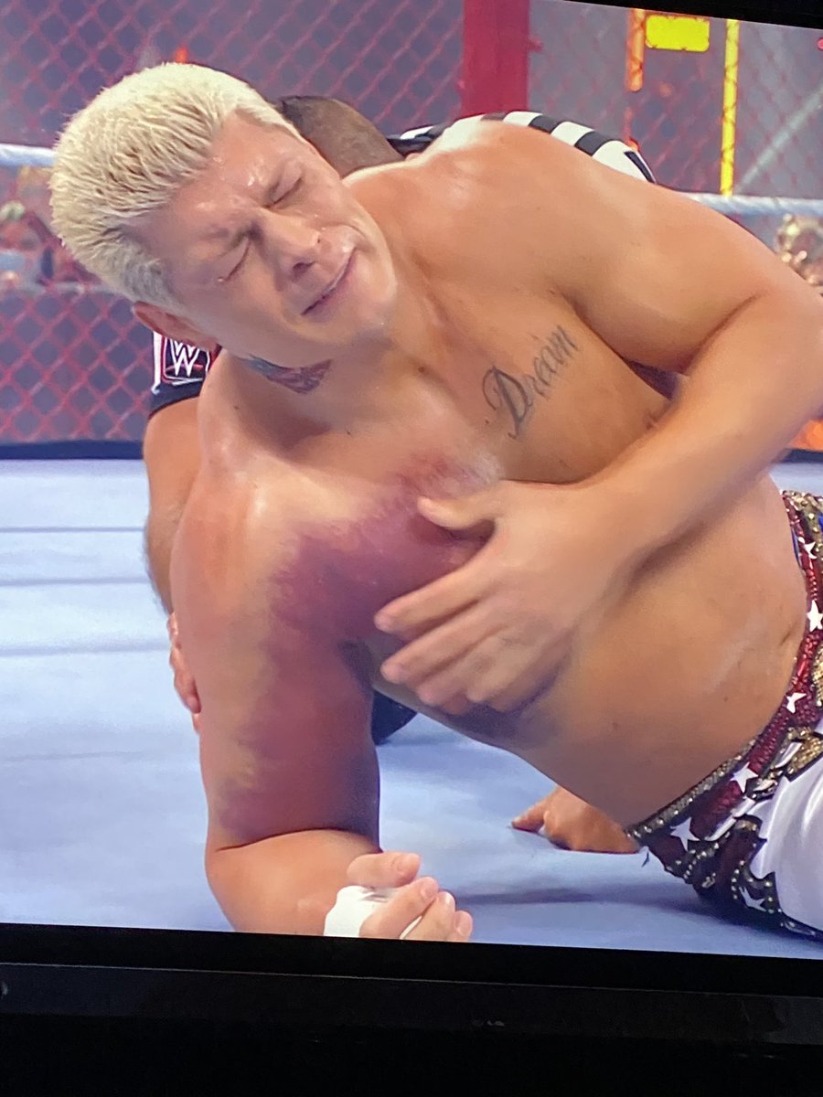 Ric_Alvarez's tweet photo. This is what a torn pec looks like. @CodyRhodes does not need to be in this match. @WWE and @VinceMcMahon should’ve protected Cody from himself. This is not worth it #codyrhodes #wwe #hiac #HellInACell #sethrollins #tornpec https://t.co/USnnlob3te