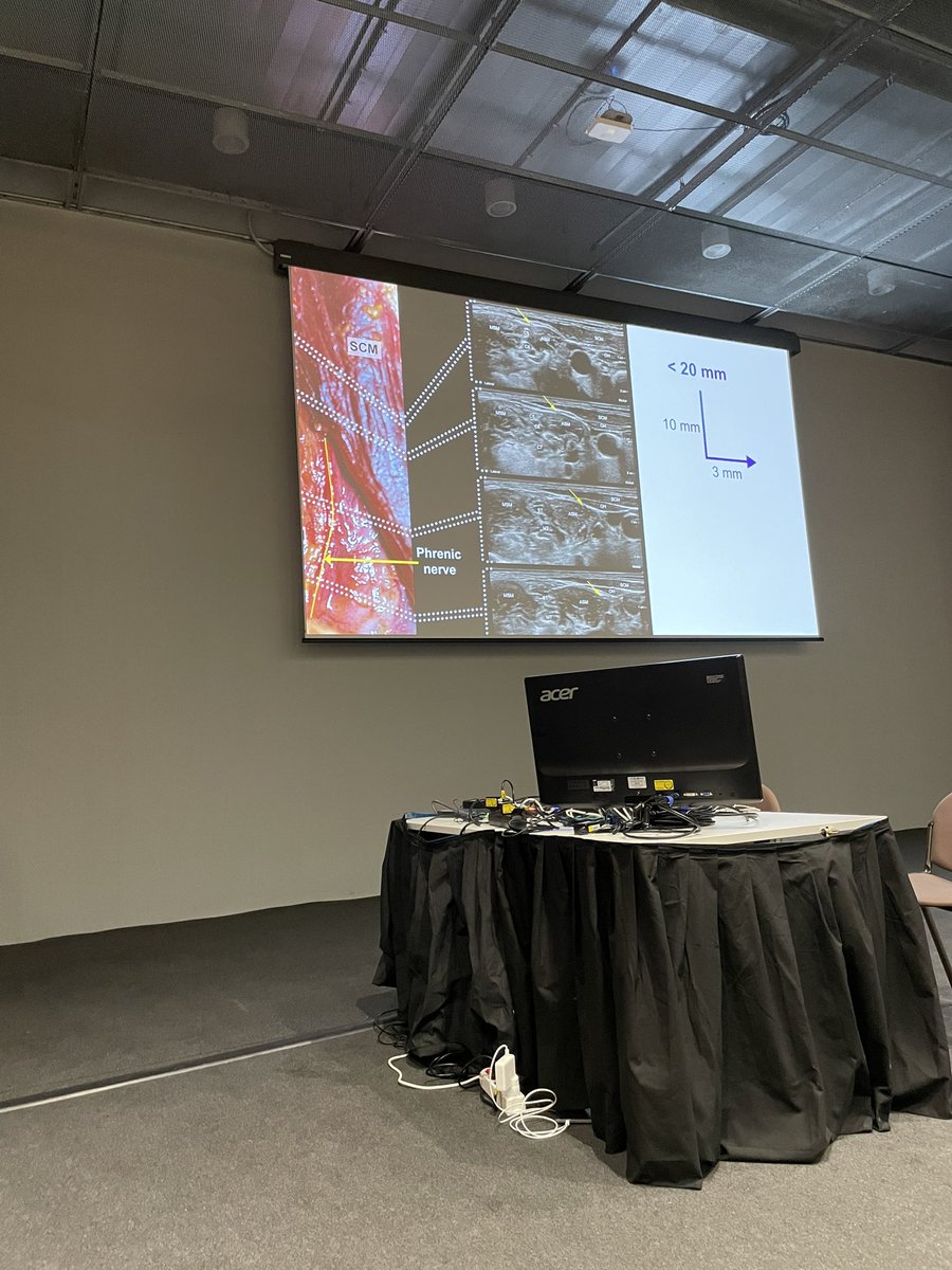 ajrmacfarlane's tweet photo. @elboghdadly discussing phrenic nerve palsy in shoulder surgery.

Volume - even 5mls 30% risk
Drug - less with lower conc.
Site - less with extra fascial, superior trunk
Catheter - avoid infusion; bolus instead, consider lidocaine and saline washout if phrenic issue

#EA22 https://t.co/cl1sOygLWZ