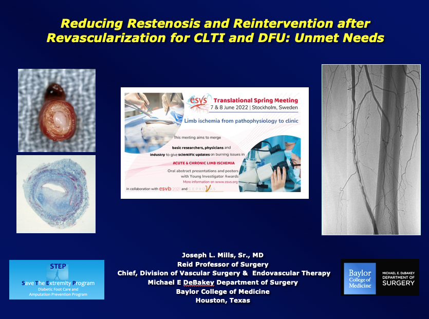 jmills1955's tweet photo. And my talk is ready to go ! #Restenosis #PAD #CLTI #ComprehensiveVascularCare #SoMeSurgery https://t.co/XUP7LpFzhK
