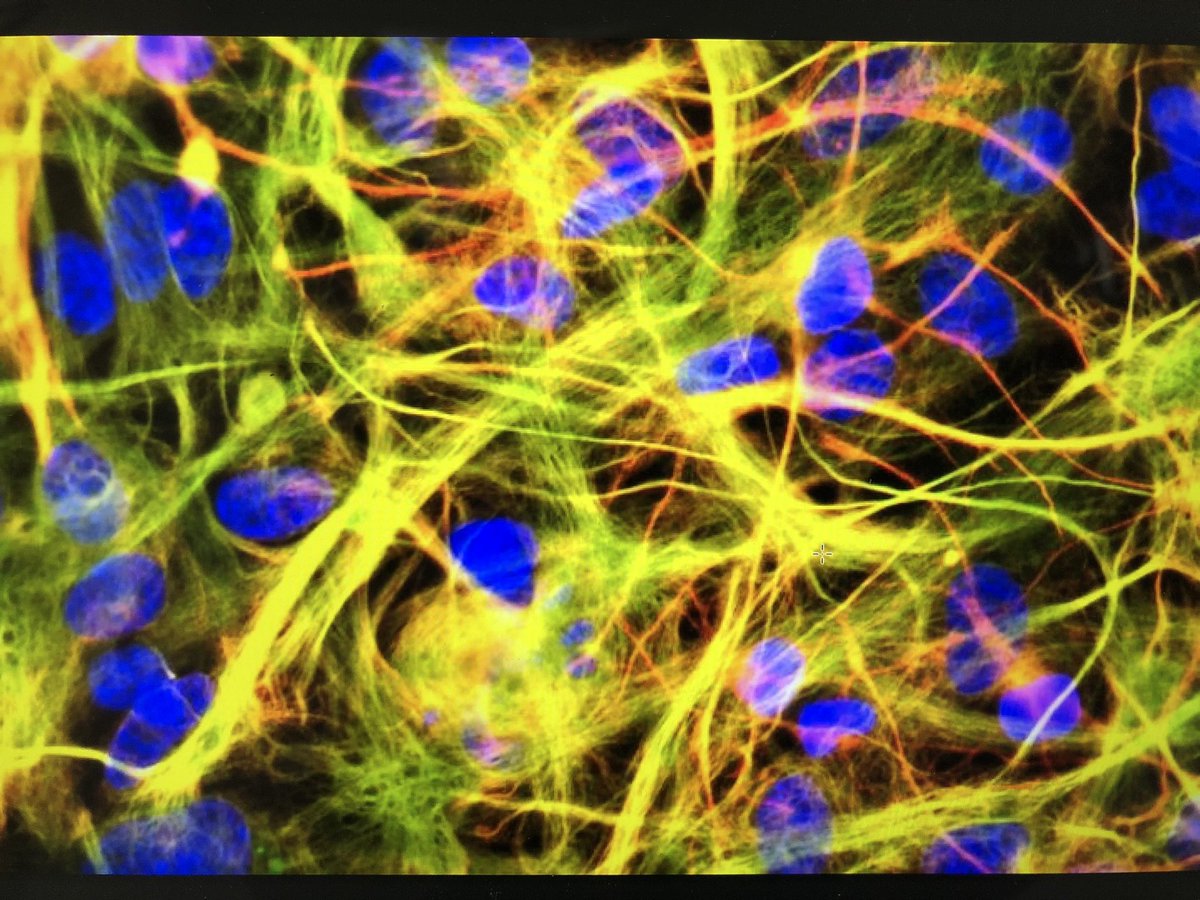 Warren lab (@drwarrenlab) on Twitter photo Want to work with neurons and glia in the spinal cord? Join my lab! <a href="/PostdocP/">Post-doc Positions</a> <a href="/PostdocJobs/">PostdocJobs.com</a> <a href="/jobRxiv/">jobRxiv</a> <a href="/thepostdoctoral/">The Postdoctoral</a> #spinalcordinjury #postdocposition #postdocjobs #universityjobs #ScienceJobs #postdoc 
eur03.safelinks.protection.outlook.com/?url=https%3A%… Want to work with neurons and glia in the spinal cord? Join my lab! <a href="/PostdocP/">Post-doc Positions</a> <a href="/PostdocJobs/">PostdocJobs.com</a> <a href="/jobRxiv/">jobRxiv</a> <a href="/thepostdoctoral/">The Postdoctoral</a> #spinalcordinjury #postdocposition #postdocjobs #universityjobs #ScienceJobs #postdoc 
eur03.safelinks.protection.outlook.com/?url=https%3A%…