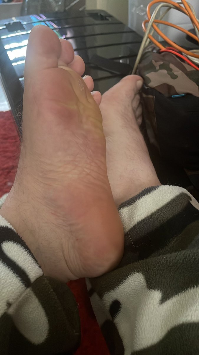 barefootkink's tweet photo. https://t.co/HmU3Xzm6mK