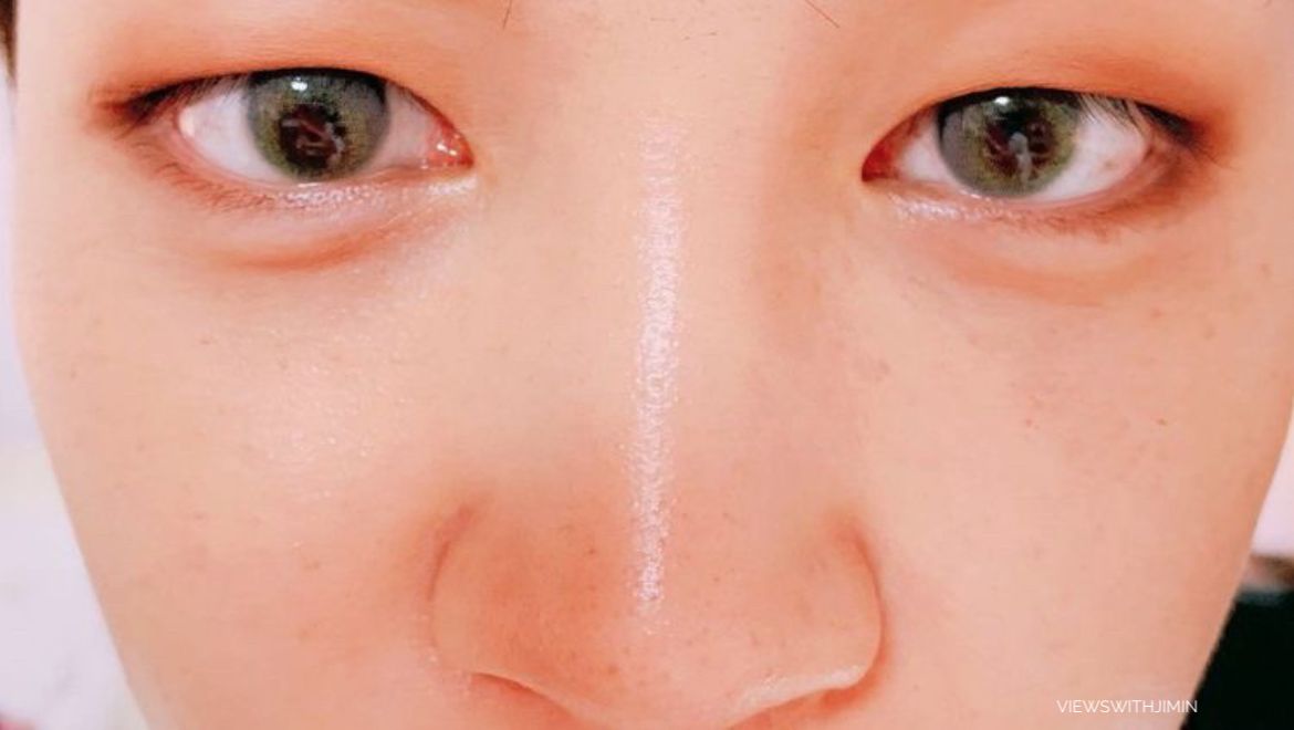viewswithjimin's tweet photo. jimins freckles aka the cutest things ever 🫶 https://t.co/bgsoTaRQds