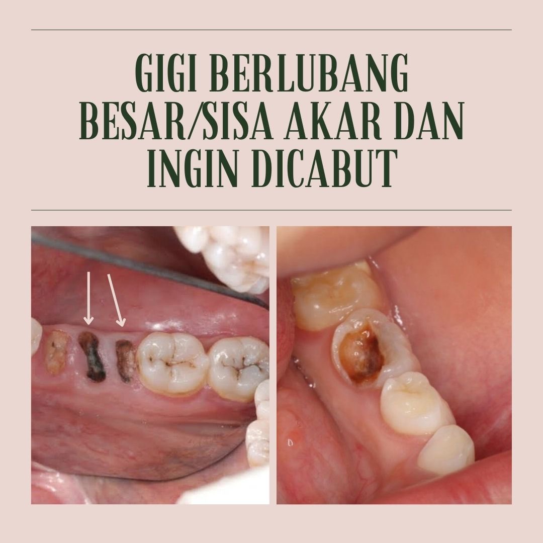 paramardhikaxvr's tweet photo. Halo! Saya Asti, koas kedokteran gigi.

Kalau anda/keluarga/teman/kenalan anda memiliki keluhan gigi dan mulut seperti di gambar dapat menghubungi saya melalui DM! 😉 https://t.co/wInHYDNZkK