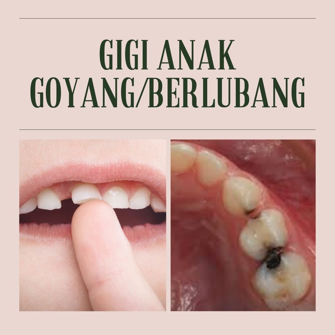 paramardhikaxvr's tweet photo. Halo! Saya Asti, koas kedokteran gigi.

Kalau anda/keluarga/teman/kenalan anda memiliki keluhan gigi dan mulut seperti di gambar dapat menghubungi saya melalui DM! 😉 https://t.co/wInHYDNZkK