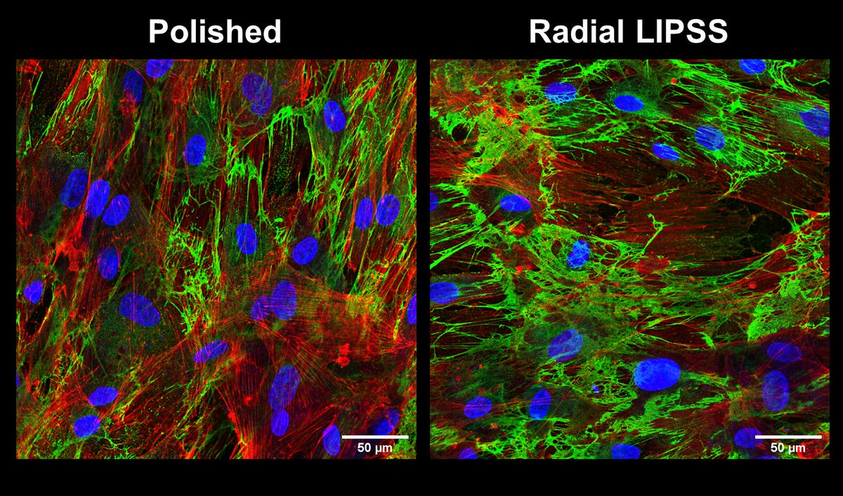 Nano_MDPI's tweet image. 📌 Polarization of #Femtosecond Laser for Titanium #Alloy #Nanopatterning Influences Osteoblastic Differentiation

Read the full #openaccess publication: mdpi.com/2079-4991/12/1…