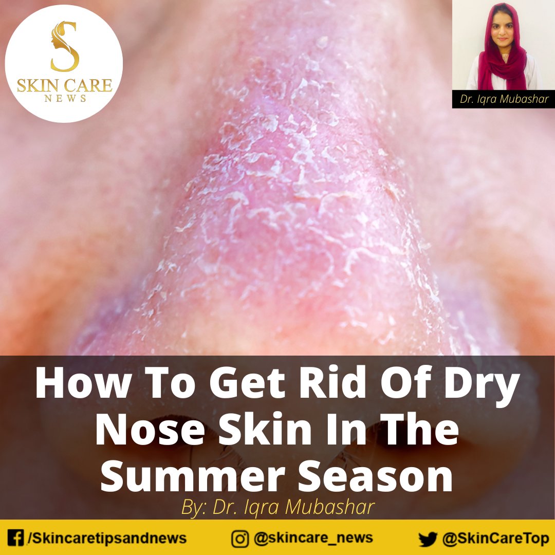 SkincareTop's tweet photo. How To Get Rid Of Dry Nose Skin In The Summer Season

Read the complete article at https://t.co/awwuo9x1bE

#dryskin #skincare #oilyskin #skincareroutine #sensitiveskin #healthyskin #eczema #skin #beauty #naturalskincare #acne #skincareproducts #skincaretips 

#skinlove https://t.co/YrsCCBvrH0