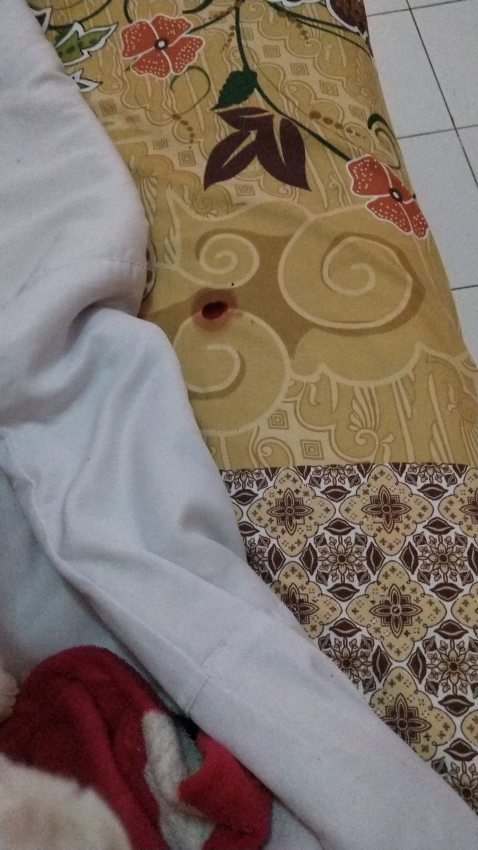mcflurybites's tweet photo. @atisachana aku pikir kucing aku hamil,ternyata bukan. dan uda sempet nanya ke dokter hewan mahal banget biayanya ,kondisi sekarang dia masi meong meonh dan keluar darah dari vaginanya https://t.co/bC12Ww2aOo