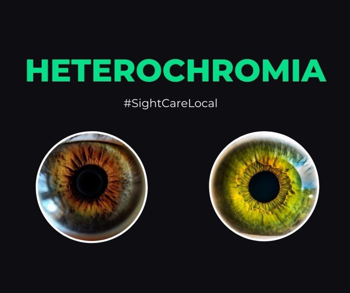 Heterochromia is the name for having two different coloured eyes. Some  famous people with this include Kate Bosworth, Demi Moore and Benedict  Cumberbatch #FunFacts #SightCareLocal, image size:1200x1006
