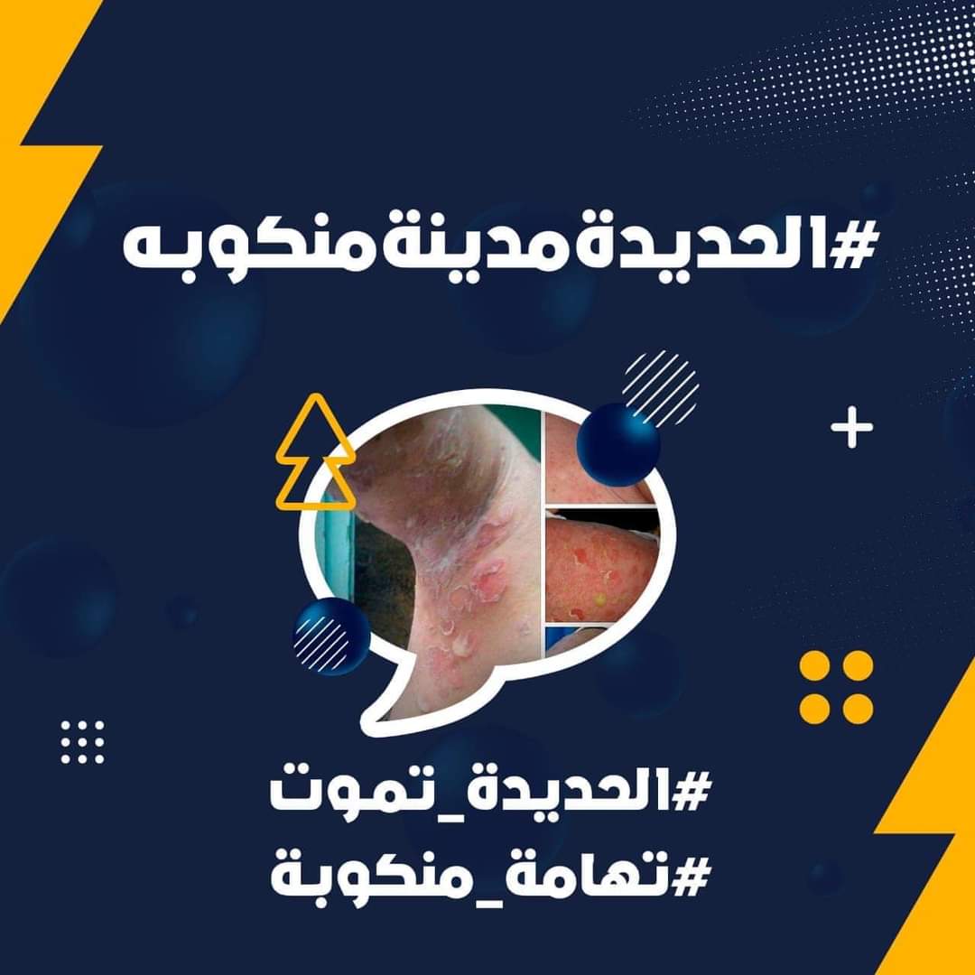 MustafaAfeef1's tweet photo. مليارات يتم تحصيلها من واردات ميناء الحديدة بإسم الكهرباء ، والنتيجة كهرباء لثلاث ساعات وسعرها أضعاف عما كانت عليه من قبل

#الحديدة_تموت
#الحديدة_مدينة_منكوبه
#تهامة_منكوبة
#الحديدة_بلا_كهرباء
#الحديدة_مدينة_منكوبة https://t.co/GWbUXowHQU