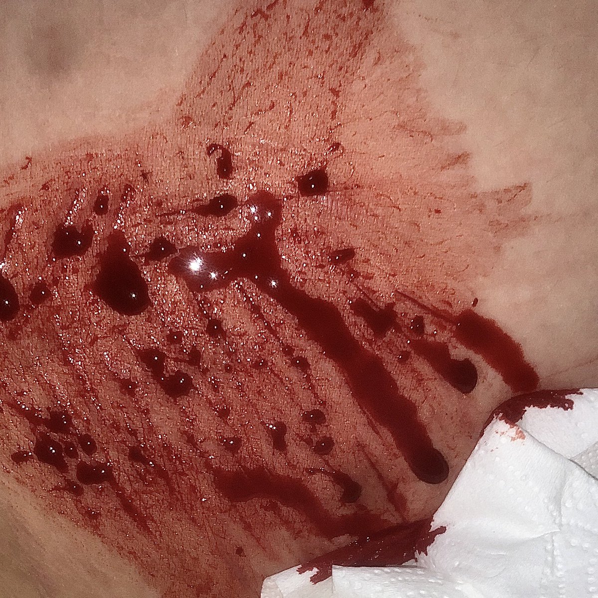 Sh4Rnboo's tweet photo. // s/h
FAKE BLOOD SFX MAKEUP
the FAKE blood made a penis shape lmfao
.
.
.
🏷 #shtwt #beanstwt #madeofstyro #madeofstyrofoam #raspberryfillingtwt #gore #catscratchtwt #shscars
#sliceytwt #danishpastrytwt #madeofbeans #scabtwt #barcodetwt #armgills #armgillstwt https://t.co/vbcVtEEUr6
