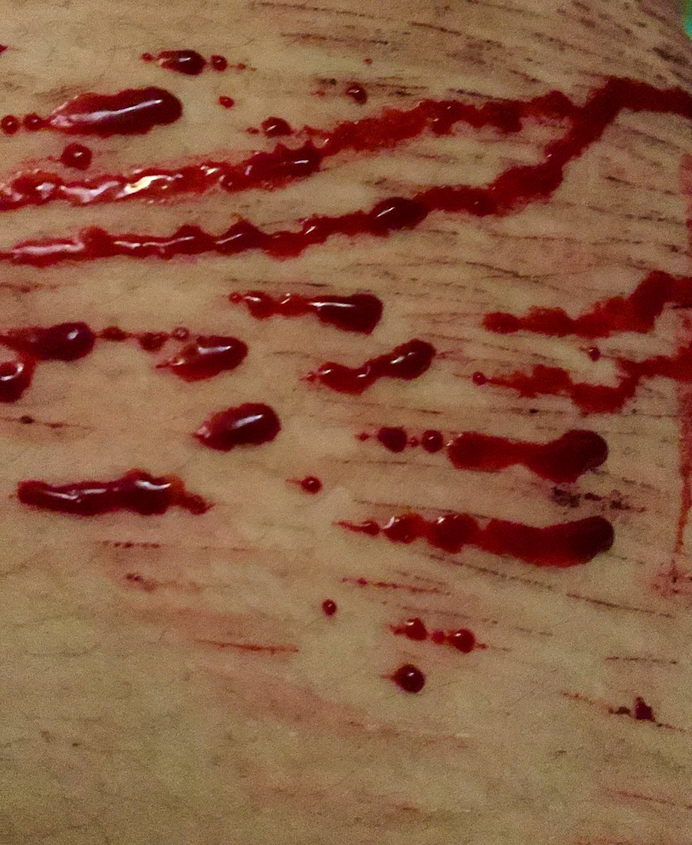 kittelody's tweet photo. blood leaked through my sheets blood running from me #kittycore #catscratchestwt #shtwt https://t.co/ICXnp8nM7T