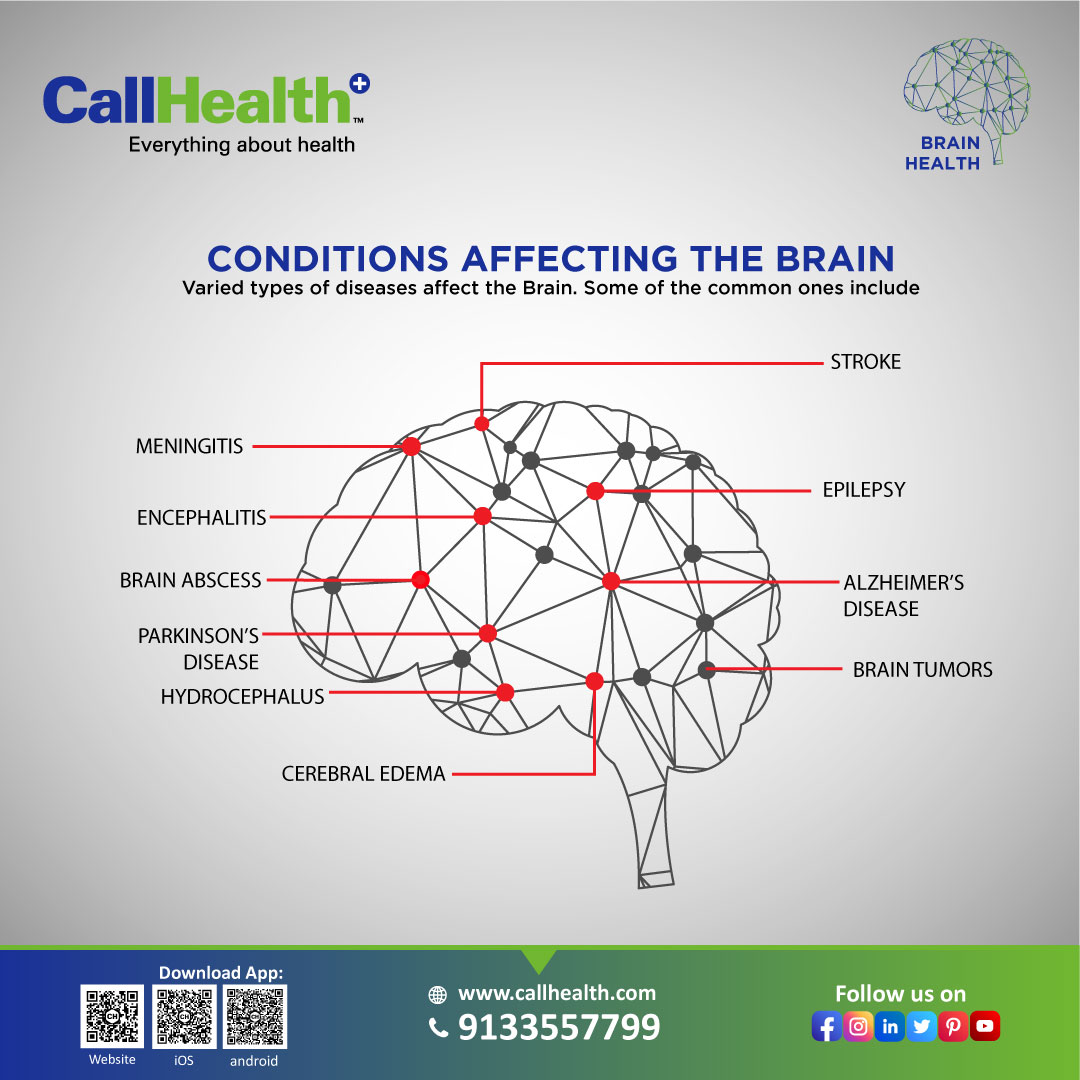 CallHealthIndia's tweet photo. 🧠 Brain Health!
Partial or complete stop of blood supply to brain can cause a stroke, brain attack or related conditions. Check out Conditions that affecting the Brain.
#CallHealth-#EverythingAboutHealth
#brain #brainhealth #awareness #health #brainstroke #brainattack https://t.co/euDV9hYdwP