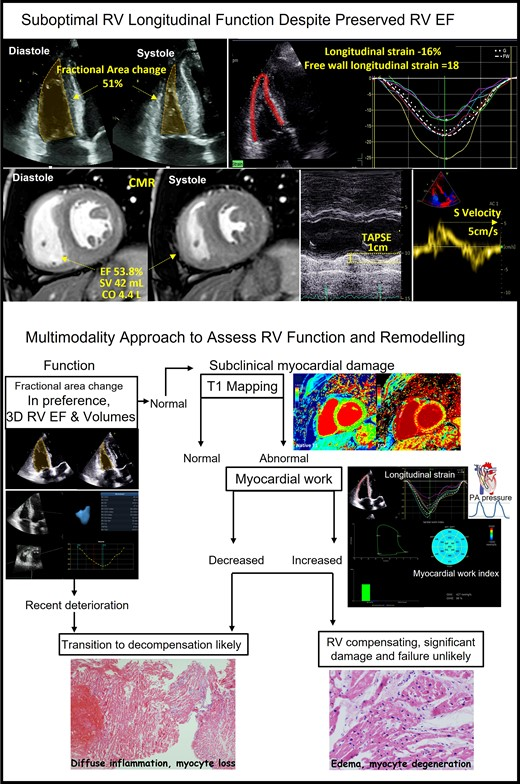 LEYLA ELIF SADE (@leylaelifsade) on Twitter photo Approach to optimal assessment of right ventricular remodelling: myocardial work index, T1 mapping, and endomyocardial biopsy academic.oup.com/ehjcimaging/ad… <a href="/DonalErwan/">Donal</a> <a href="/VDelgadoGarcia/">Victoria Delgado</a> <a href="/Cosyns/">Cosyns Bernard</a> <a href="/ThorEdvardsen/">Thor Edvardsen</a> <a href="/unlu__serkan/">Serkan Ünlü</a> #echofirst #heartfailure Approach to optimal assessment of right ventricular remodelling: myocardial work index, T1 mapping, and endomyocardial biopsy academic.oup.com/ehjcimaging/ad… <a href="/DonalErwan/">Donal</a> <a href="/VDelgadoGarcia/">Victoria Delgado</a> <a href="/Cosyns/">Cosyns Bernard</a> <a href="/ThorEdvardsen/">Thor Edvardsen</a> <a href="/unlu__serkan/">Serkan Ünlü</a> #echofirst #heartfailure