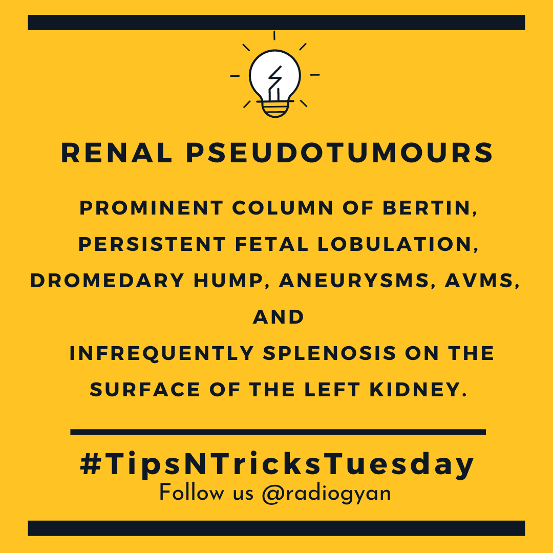 TeamRadioGyan's tweet photo. #TipsnTricksTuesday 

Here is a pearl about  renal pseudotumours

All credits to #TeamGyan member Dr. Disha Lokhandwala.
Follow her on Instagram @dishasradiologyillustrations.

#gut #kidney #nephro #uro
#Foam #radres #radiogyan    
#radiology #education #internet https://t.co/PskFOw4JLj