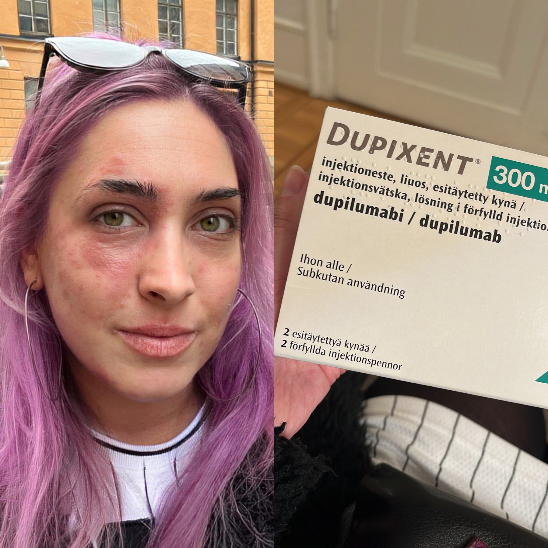 Dupixent Commercial Actorscareer Detail - fpj7jgi