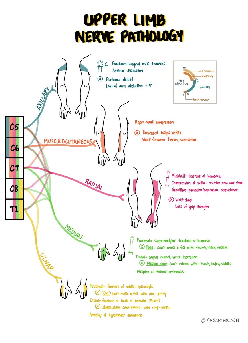 USMLEStepStudy's tweet photo. Neuro "Doodles":  Identifying Upper and Lower Limb Nerve Pathology by @sarahthelyon https://t.co/Mfrf17ATzP