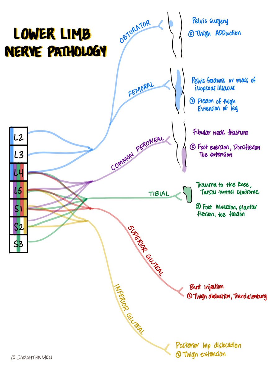 Neuro "Doodles":  Identifying Upper and Lower Limb Nerve Pathology by <a href="/sarahthelyon/">Sarah Lyon MD</a>