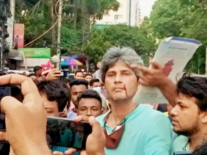 basherkella's tweet photo. Activists of #Bangladesh Chhatra League (BCL) of #Chattogram Medical College unit attacked Junaid Saki &amp; his co-activists while he was leaving the hospital after visiting the patients injured in the fire at #BMContainer Depot in #Sitakunda upazila of Chattogram.

#Dhaka
#BanBCL https://t.co/vGmB3Foybg