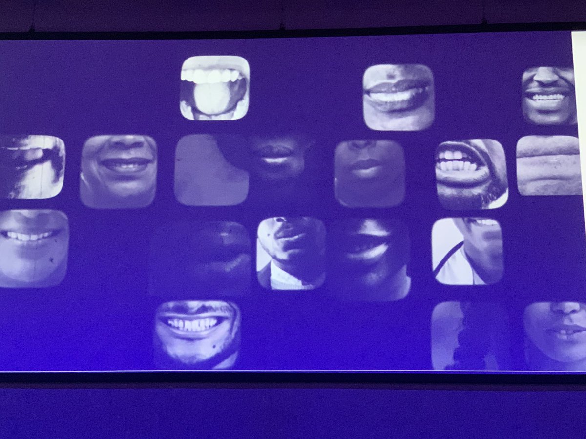 ‘When people look the other way it spreads, like a contagion’

‘When you see injustice - speak out’

Nurses recounting heartbreaking experiences of racism during pandemic, in fringe event at #RCNcongress2022, and urging all to speak out against racism.