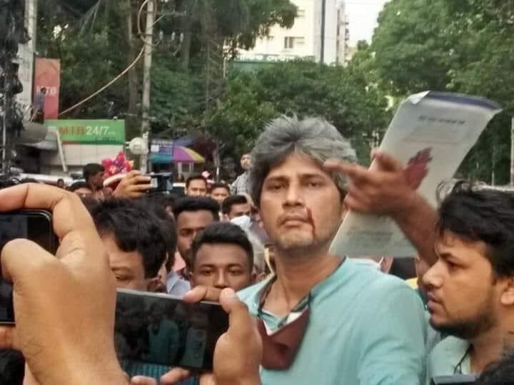 সতীকুন্ডের বিএম কনটেইনার ডিপোর অগ্নিকান্ডে আহতদের চট্টগ্রাম মেডিকেল হাসপাতালে দেখতে গেলে গণসংহতি আন্দোলনের  প্রধান সমন্বয়ক জুনায়েদ সাকির উপর ছাত্রলীগ হামলা করে। স্বৈরাচার হটিয়ে গনতান্ত্রিক বাংলাদেশ  হইবে হবে ইনশাআল্লাহ। 
#TakeBackBangladesh ঙ
