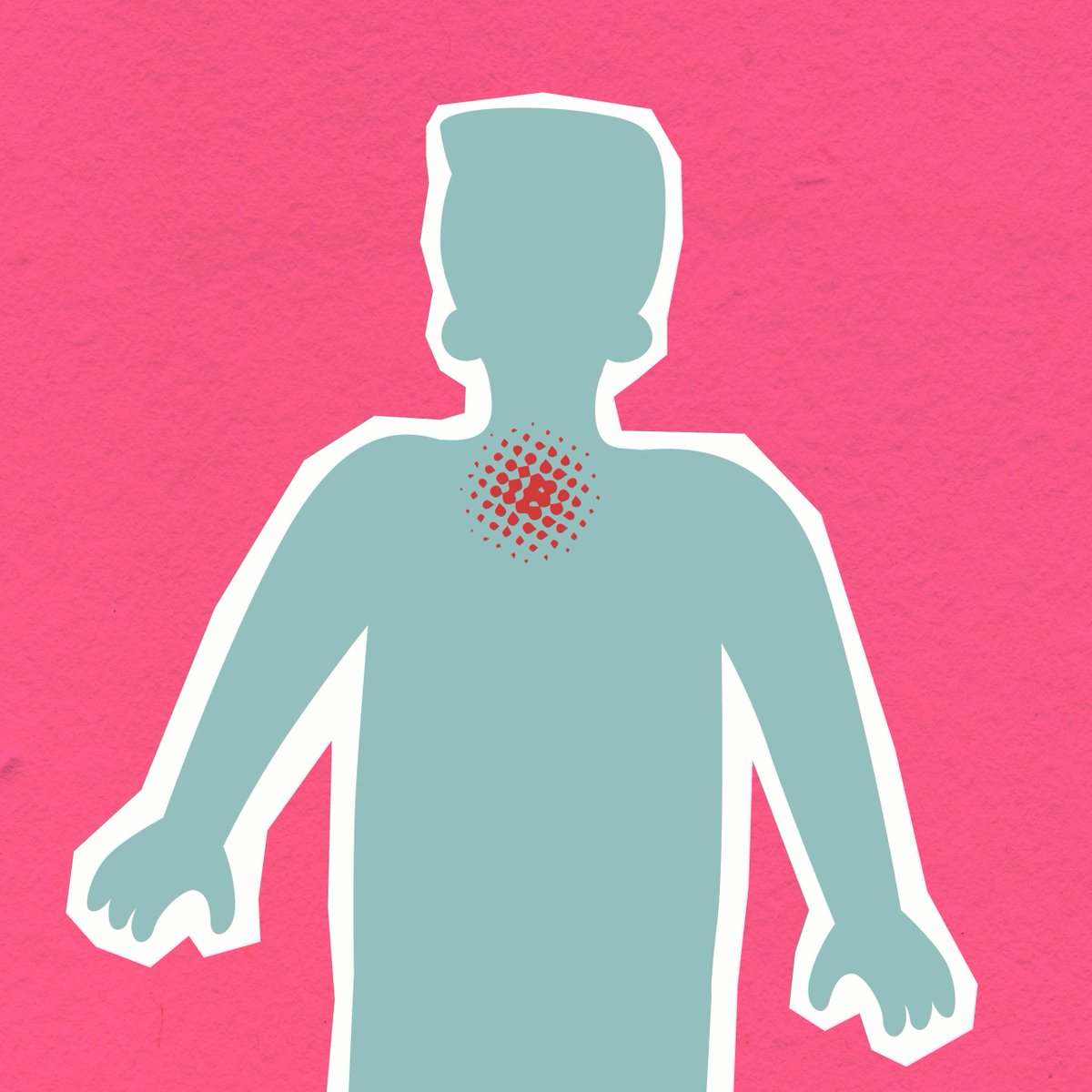 IARC (@iarcwho) on Twitter photo IARC scientist <a href="/EileenMorgan_/">Eileen Morgan</a> & colleagues estimates the šburden of oesophageal #cancer will āļø by 50+% from 2020 to 2040 to ~1 million cases/year, & details current & future landscape of #OesophagealCancer to aid in setting primary prevention priorities doi.org/10.1053/j.gast⦠IARC scientist <a href="/EileenMorgan_/">Eileen Morgan</a> & colleagues estimates the šburden of oesophageal #cancer will āļø by 50+% from 2020 to 2040 to ~1 million cases/year, & details current & future landscape of #OesophagealCancer to aid in setting primary prevention priorities doi.org/10.1053/j.gastā¦