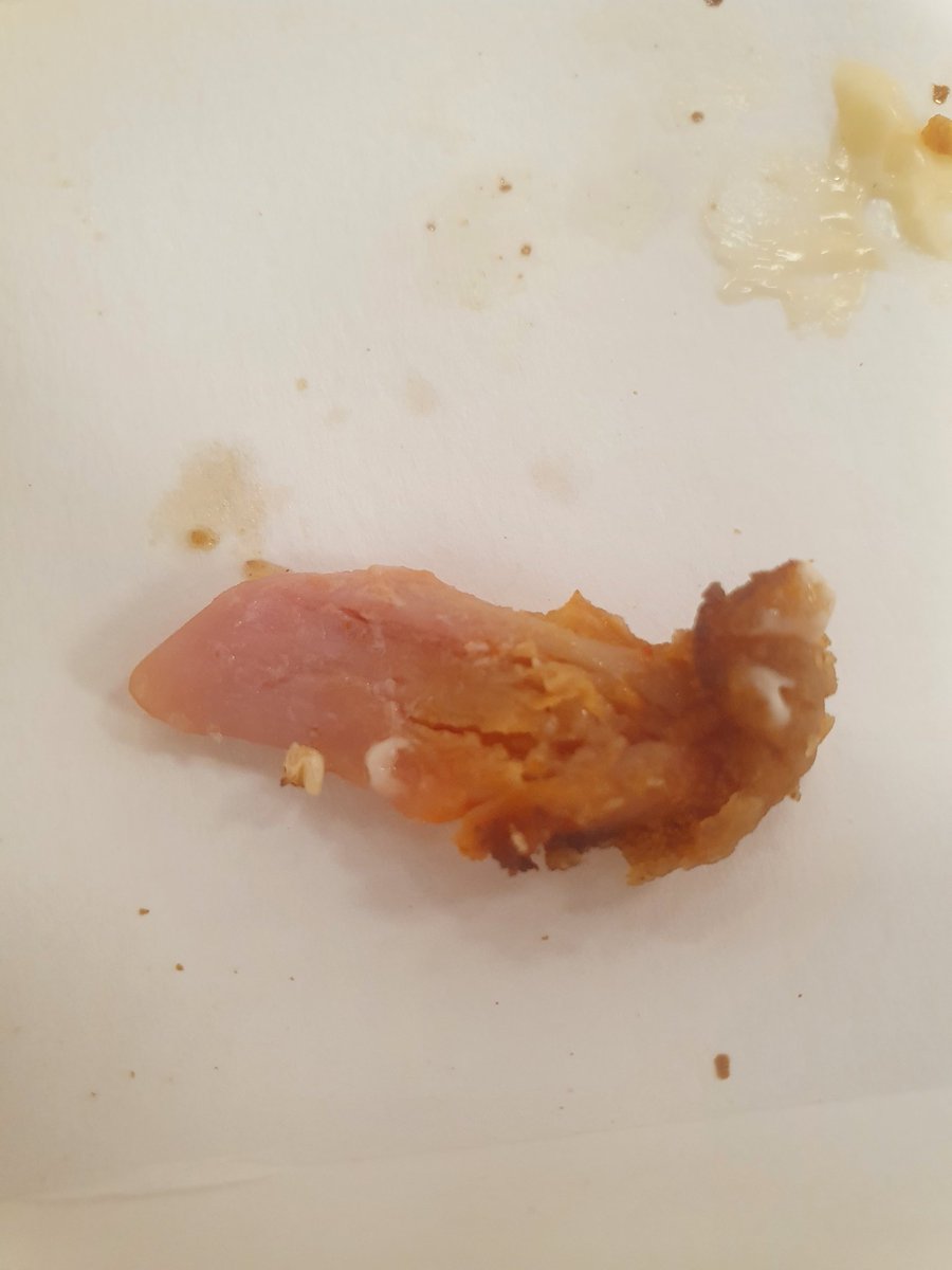 RyanWightman17's tweet photo. I have tried to use your online form to contact yourselves about uncooked food I paid for today. Could someone from @kfc get in touch as your online form is rubbish and doesn't work. Thanks in advance 
#FatManNotHappy 
#KFCCares 
#undercooked https://t.co/u4e4T2xSxD