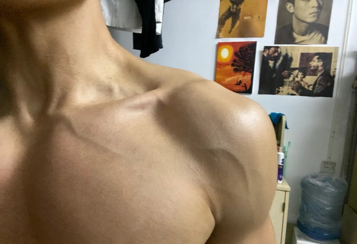 选一个   如果你是护士扎那一根