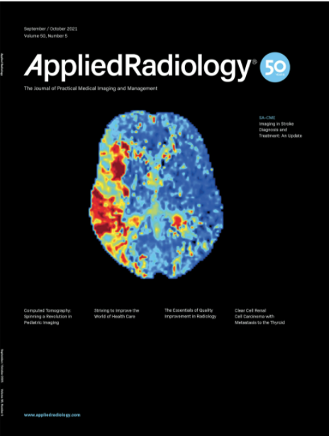 Applied_Rad's tweet photo. Attention Medical Professional! Did you know Applied Radiology is complimentary? Sign Up Today!
Applied Radiology Journal: https://t.co/FGifRma3Ja
Applied Radiology Educational Alert https://t.co/TDn9YpTjky
#SACME #RadRes #RadFellow #Radiologist #MedPhys #RadAdmin #RadTech https://t.co/AUOOnuGrin