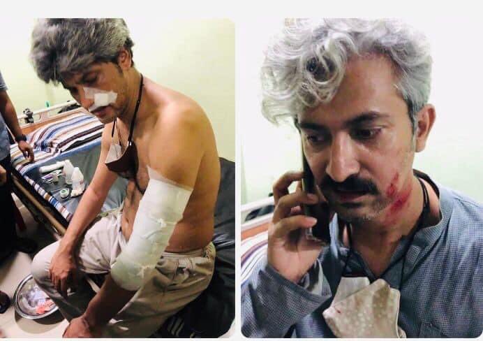 সীতাকুণ্ডের ভয়াবহ অগ্নিকাণ্ডে আহতদের হাসপাতালে দেখতে যান গণসংহতি আন্দোলনের চেয়ারম্যান জোনায়েদ সাকি ভাই ওছাত্র অধিকার পরিষধ নেতা রাশেদ খান।সেখানে'জয় বাংলা'বলে তাদের ওপর হামলা চালায় ছাত্রলীগ।পরবর্তীতে হাসপাতালের নার্সদের ওপরেও হামলা চালায় তারা।আহত কাউকে দেখতে যাওয়া কি অপরাধ?