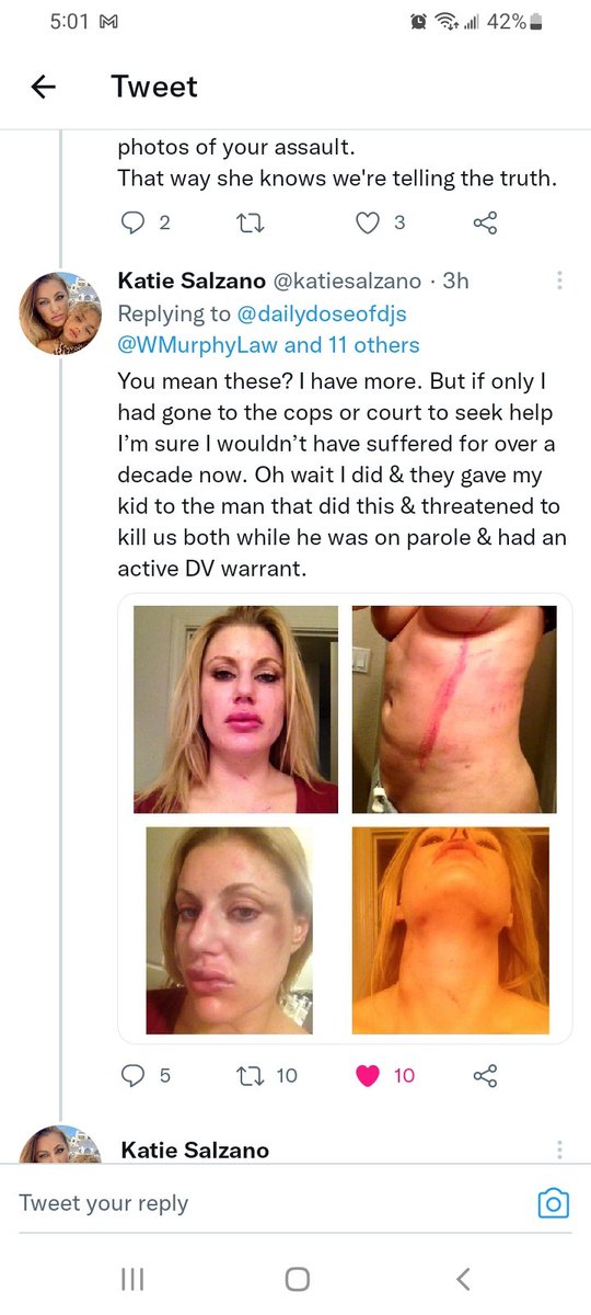 dailydoseofdjs's tweet photo. @UberHansen This woman was beaten by @NFL player. Nothing and I mean nothing happened to him. 

The @NFL doesn't give AF about women or the men that abuse them. 
#MeTooNFL https://t.co/XlenTdcvOj
