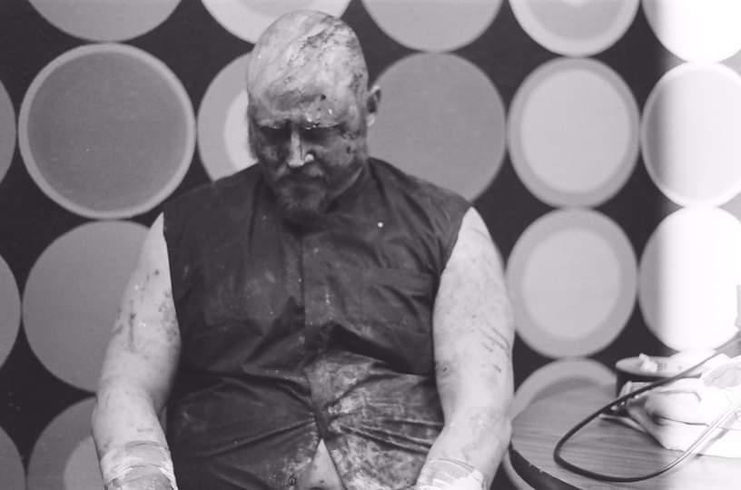 RickyNoren's tweet photo. The aftermath. 🙏🙏🙏

📸: @rdvrant

#deathmatchwrestling #deathmatch #timebombpro #noringdeathmatch #noringnorules #pastorlife https://t.co/NR7csuFn0y