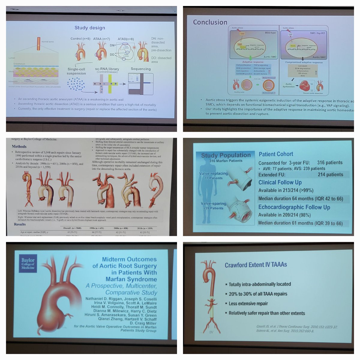 Rewarding to see my illustration contributions on display at the 10th MEDDoS Research Symposium last week. Congrats to @scottlemaire and team for a successful milestone event! #DeBakeySurgeon #aorta #medicalillustration #MedTwitter