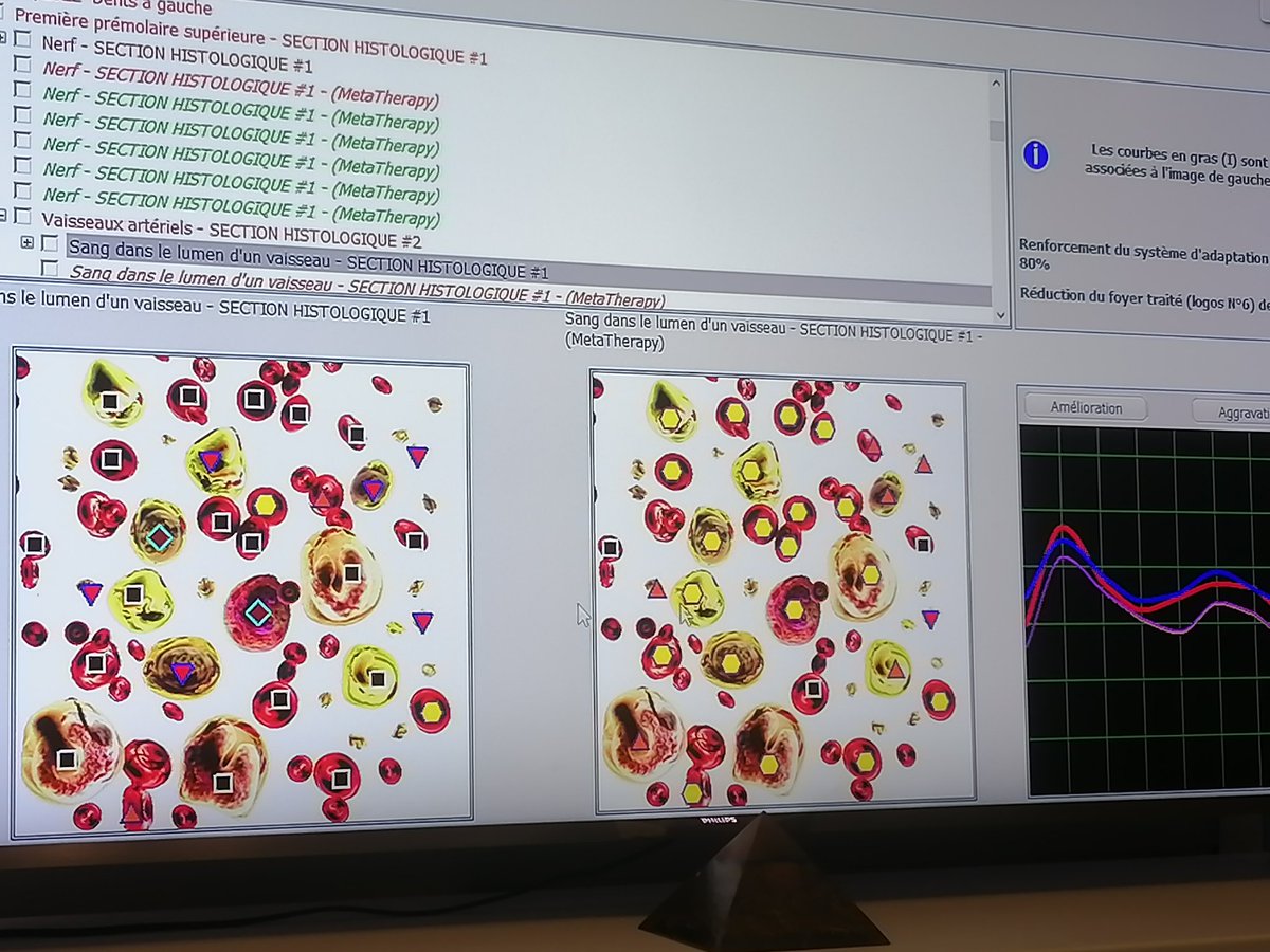 WolfAnge47's tweet photo. @gimli36 @DIVIZIO1 C'est à dire que en un bilan d'entrée vous avez tout se qui est déréglé en bioresonance et biofeedback dernier génération , pocible de renforcer les défenses immunitaire ou même de griller un virus microbe ect.. Et en plus on constate la régénération des cellules tissus cartilage https://t.co/4fnc0JcGhU
