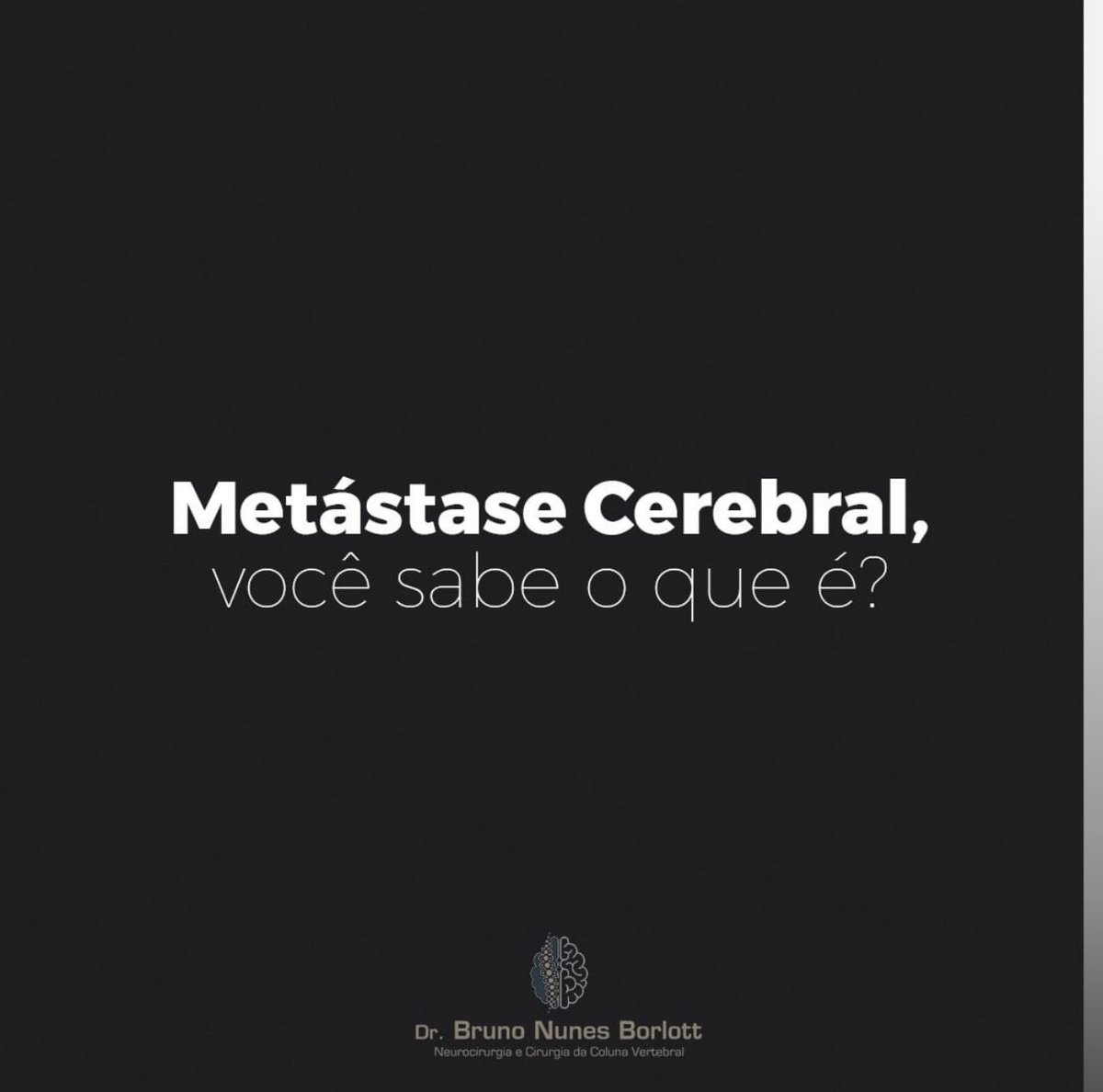 BRUNOBORLOTT's tweet photo. Metástase Cerebral, você sabe o que é?

Metástase Cerebral é um tumor no cérebro, porém tem origem em outros órgãos, principalmente proveniente de tumores no pulmão, mama, pele e rim.

Quer saber mais? Entra lá no nosso Insta! https://t.co/wYI17Fm6R5 https://t.co/6BVhcNDLV9