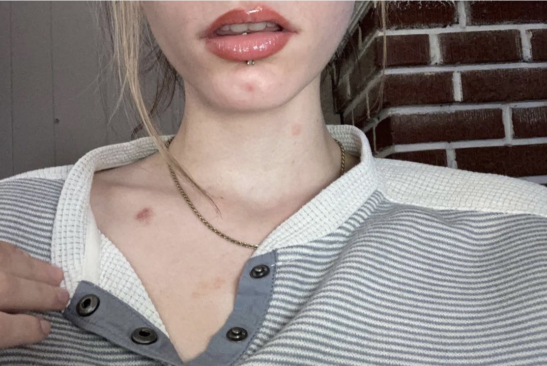 RenxBaby's tweet photo. @thekingdrastic when daddy bites https://t.co/0FhykPp9L7