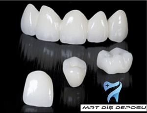 Zirkonyum kaplama uygulamasında; zirkonyumun, porselen dişin altına metal destek yerine tercih edilmesinin en önemli nedenleri, zirkonyumun estetik, sağlıklı ve sağlam materyal olmasıdır.