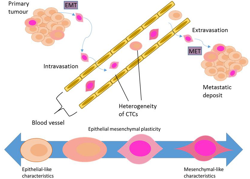 Landmark_IMR's tweet photo. Welcome to read👏Applications of RNA characterisation in circulating tumour cells, by Erik W. Thompson et al. @QUT
https://t.co/uJ69gKhxtd
#EMT #Metastasis #CTCs #Cancer #CancerResearch #RNAanalysis https://t.co/NvE27tYD3s