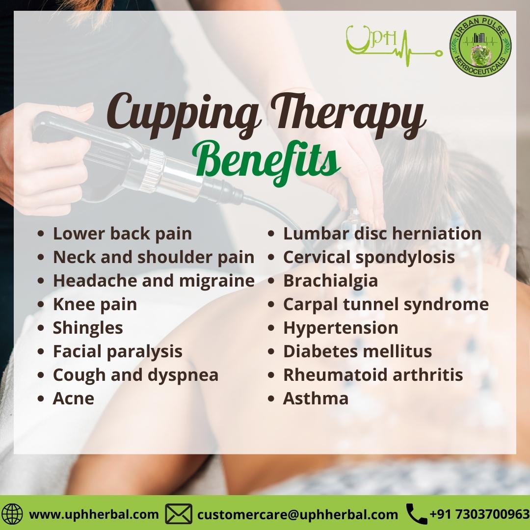 uphherbal's tweet image. Cupping therapy is an ancient form of alternative medicine in which a therapist puts special cups on your skin for a few minutes to create suction. 
For More Information:
Call Us Now: +91 7303700962
Visit at: D-3, D Block, Sector 20, Noida, Uttar Pradesh 201301
#uph #uphherbal