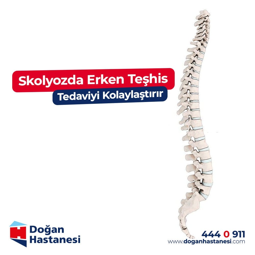 Skolyoz omurganın sağa veya sola eğilmesiyle kendini gösteren doğumsal olabildiği gibi çoğunlukla sonradan gelişen, ilerlemiş hastalarda hayat kalitesini ciddi ölçüde düşüren bir hastalıktır. Ciddiye alınarak mutlaka takip ve tedavi edilmesi gereken önemli bir omurga hastalığıdır