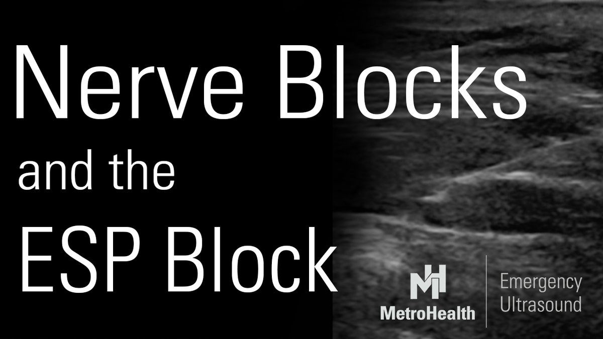 Check out the latest video from our Ultrasound Grand Rounds about Nerve Blocks and the ESP block by @POCUSaurusRex.  
youtu.be/8AFKXtQwOfk
#MetroEUS #POCUS #Ultrasound #FOAMed #FOAMus #MedTwitter #NerveBlocks